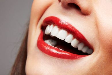 Sáu cách tự nhiên để làm trắng răng