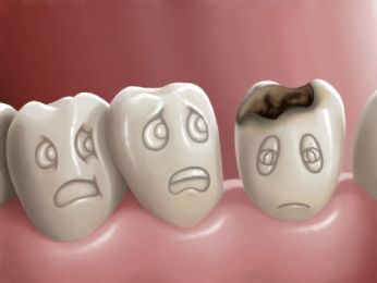 Các bệnh về răng miệng thường gặp phải ở người Việt Nam