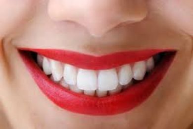 Bạn nên làm gì để ngăn ngừa sâu răng?