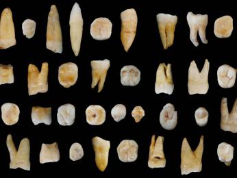 Sự tiến hóa của răng người thật đáng kinh ngạc